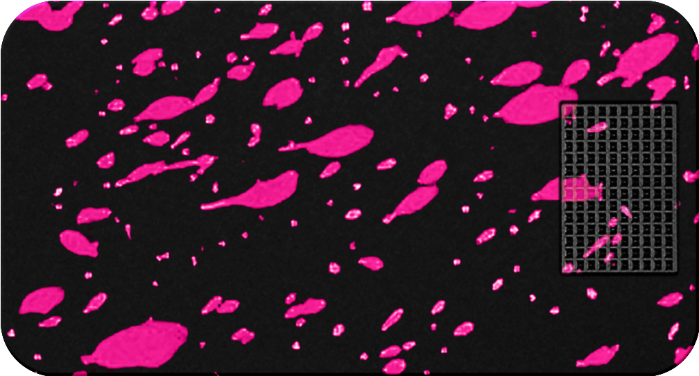 Mission_Pill_Case_Black_Pink_Splatter.png